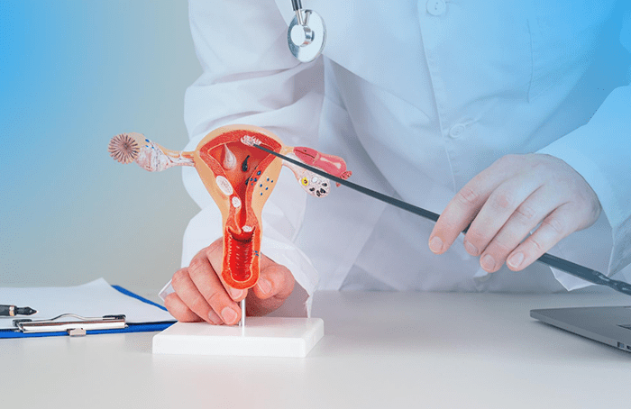 Síndrome de Ovario Poliquístico